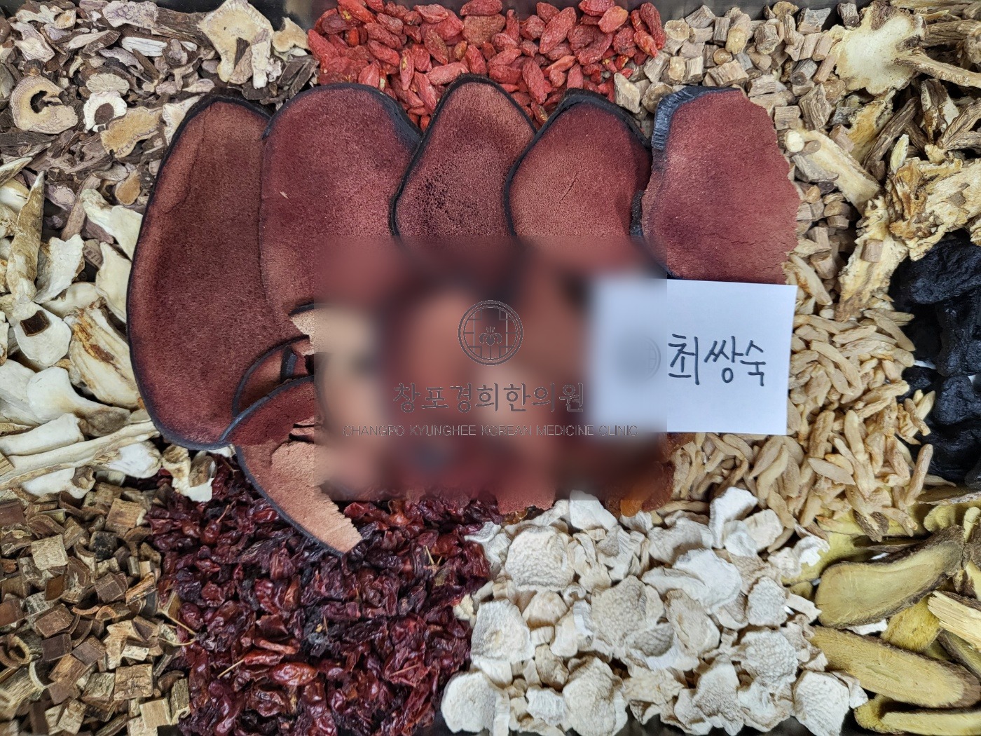 치료 관련 이미지