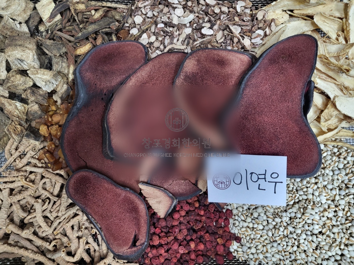 치료 관련 이미지